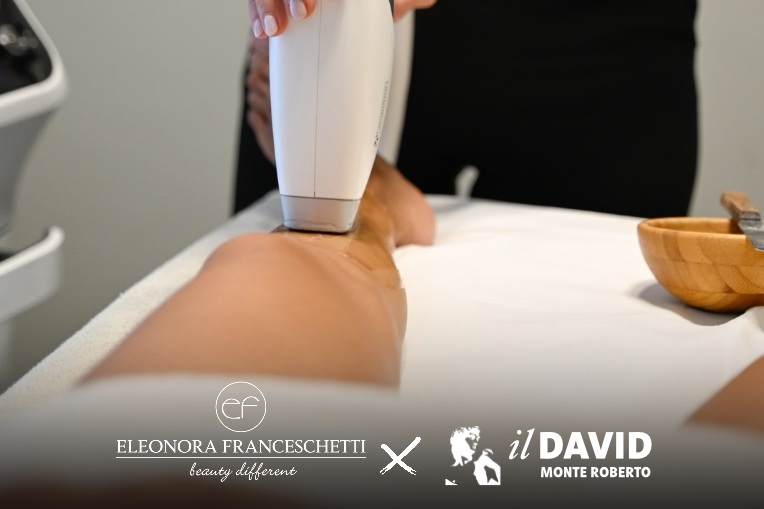 convenzione-epilazione-laser-il-david-monte-roberto